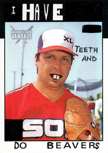 I Have XL Teeth And So Do Beavers