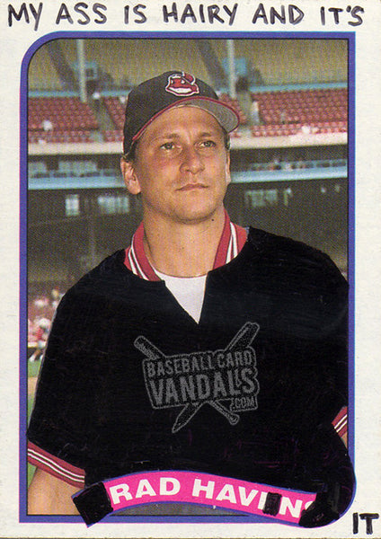 My Ass Is Hairy And It's Rad Havin' It