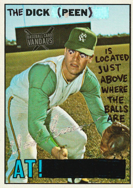 The Dick (Peen) Is Located Just Above Where The Balls Are At!