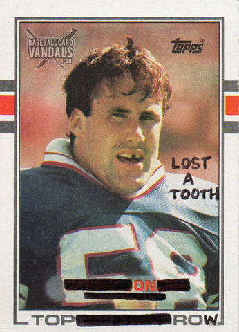 Lost A Tooth On Top Row