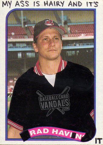 My Ass Is Hairy And It's Rad Havin' It