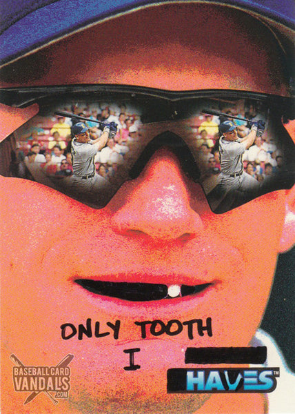 Only Tooth I Haves