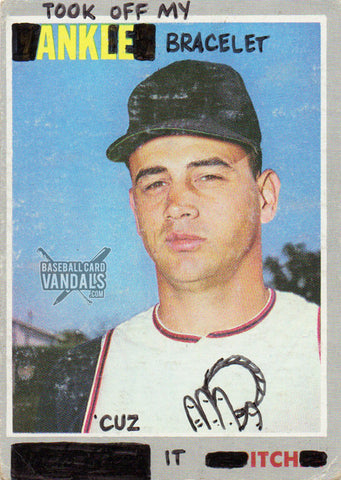 Took Off My Ankle Bracelet Cuz It Itch